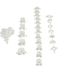 Coluna Desarticulada