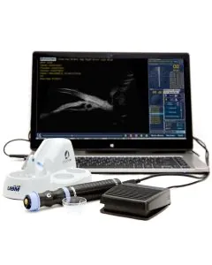 Ultrassom Ocular UBM PLUS